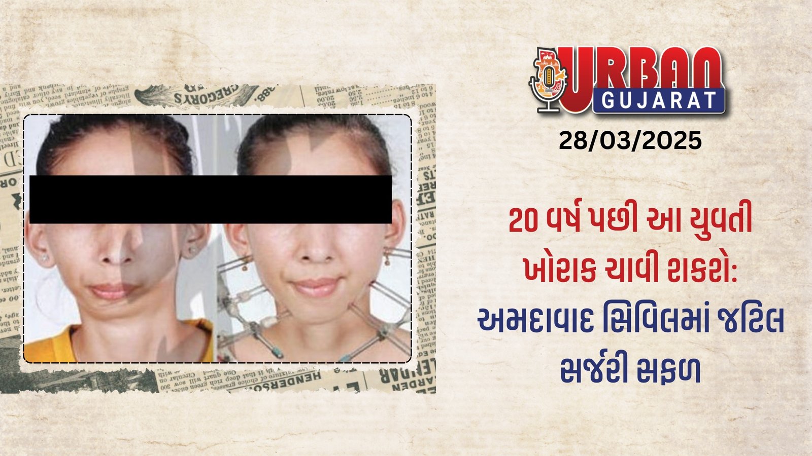 20 વર્ષ પછી આ યુવતી ખોરાક ચાવી શકશે: અમદાવાદ સિવિલમાં જટિલ સર્જરી સફળ